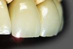 PEPPEL Dental-Technik >>> Startseite