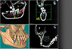 PEPPEL Implantat-Technik >>> Radiologische Diagnostik